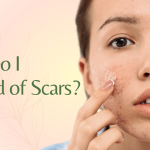 How Do I Get Rid of Scars