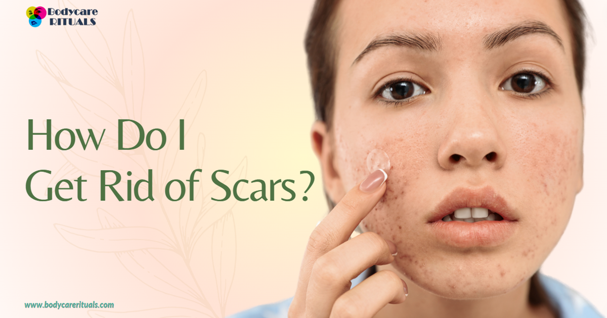 How Do I Get Rid of Scars