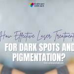 How Effective Laser Treatment for Dark Spots and Pigmentation