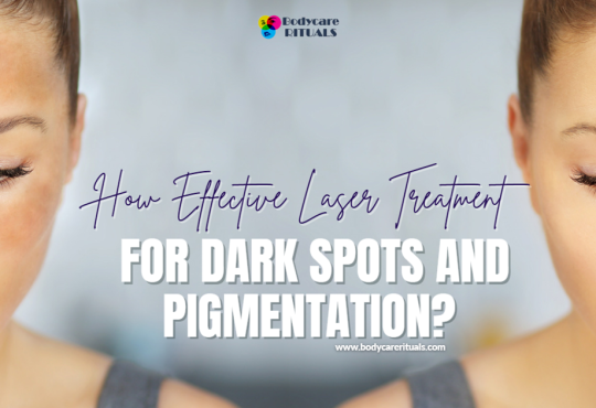 How Effective Laser Treatment for Dark Spots and Pigmentation