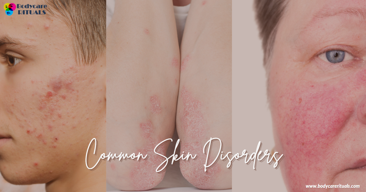Unmasking Common Skin Disorders